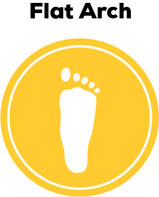 A depiction of a flat arch type.